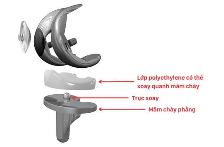 các loại khớp gối nhân tạo