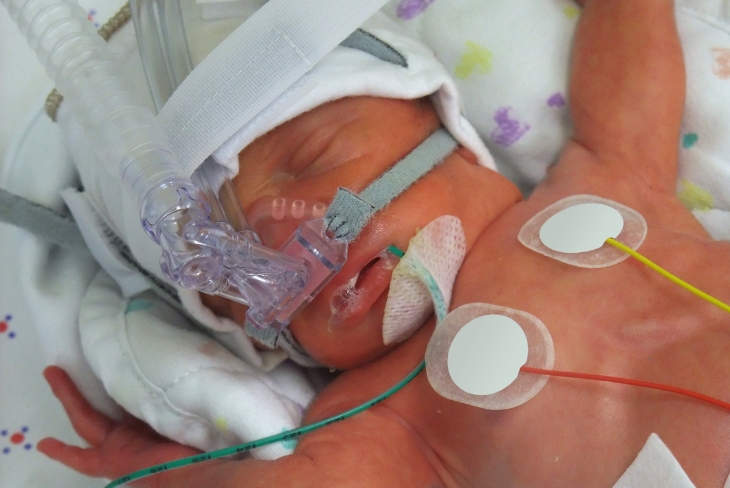 Thalassemia với thai kỳ