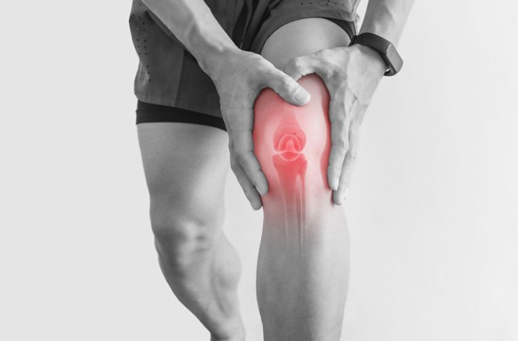 Phù nề dây chằng chéo trước