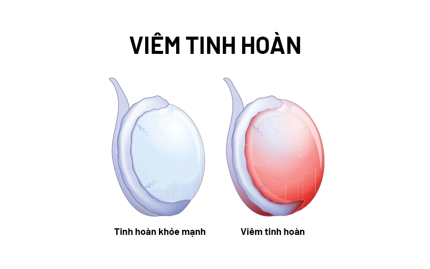 width=